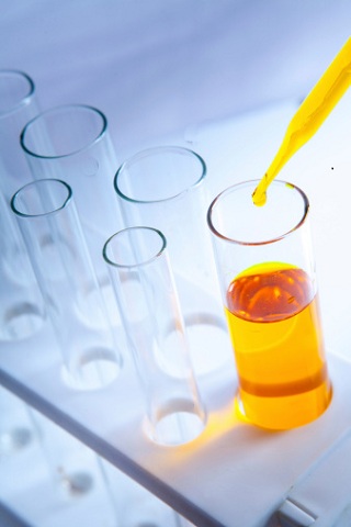 Fotografije: Thinkstock