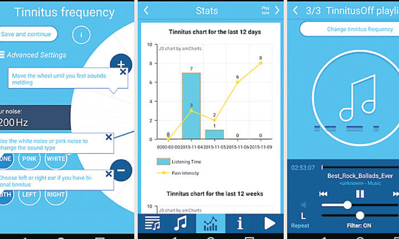Sučelje mobilne aplikacije