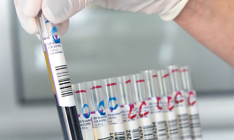 Glavni izvozni proizvod za američko tržište lani nisu bili pištolji, nego ljudska i životinjska krv